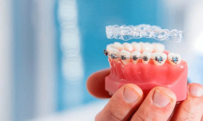 Dental Braces Stillwater