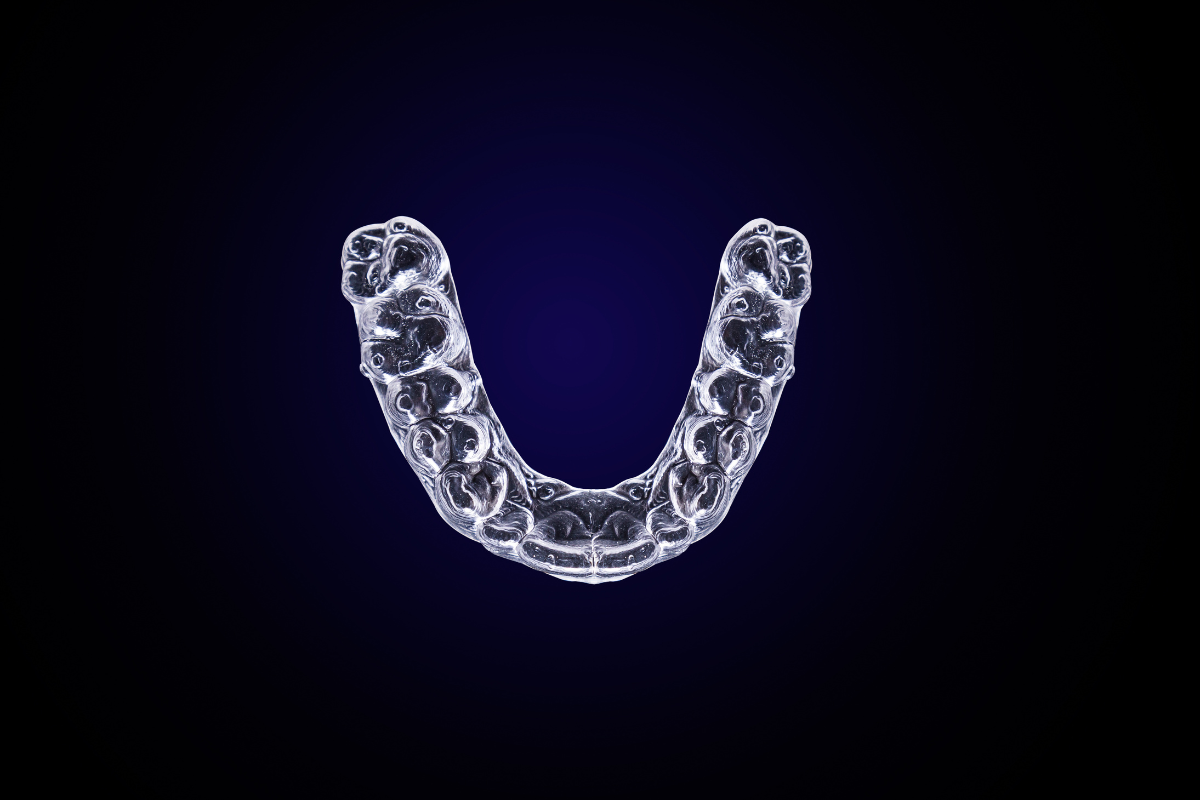 Clear dental aligner tray shown from above, displaying tooth positioning for orthodontic treatment.